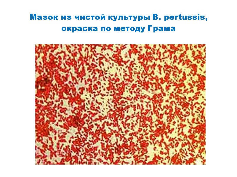 Мазок из чистой культуры B. рertussis,  окраска по методу Грама